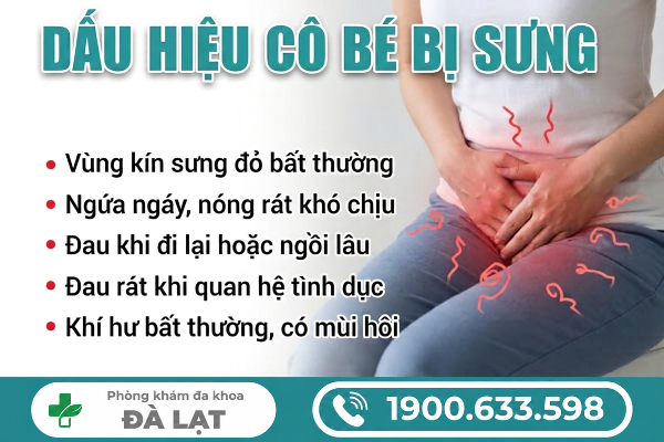 Hình ảnh minh họa